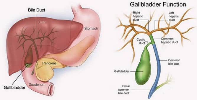 Gallbladder Stone Removal