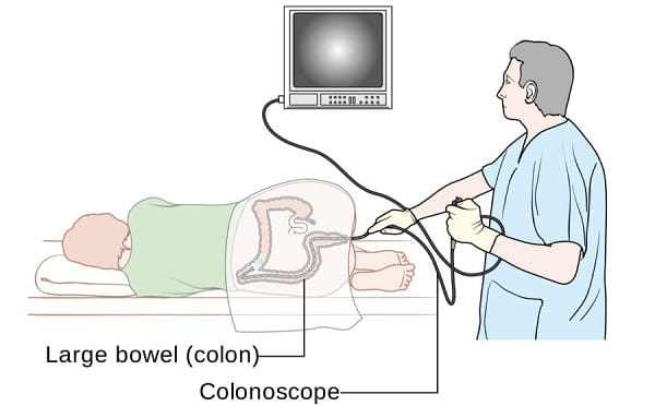 Colonoscopy Test India